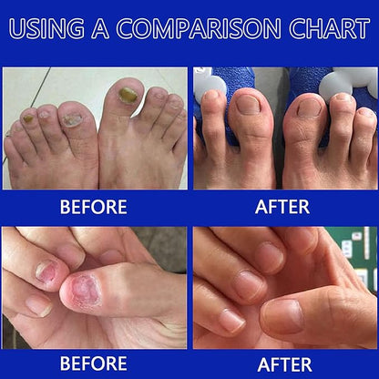 Antihongos Toenailplus